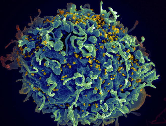 VIH: la prevención pide paso