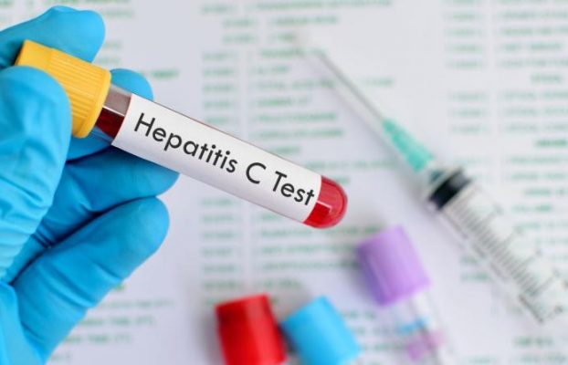 Hepatitis: la C puede eliminarse en España en cinco años