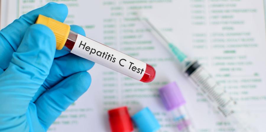 Hepatitis: la C puede eliminarse en España en cinco años
