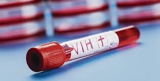 Consecuencias psicológicas en personas con VIH-SIDA